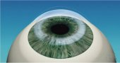 Refractive Surgery Art