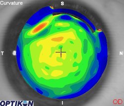 Orthok Demonstration - Patient 001