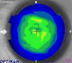 Orthok Demonstration - Patient 002