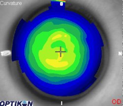 Orthok Demonstration - Patient 005