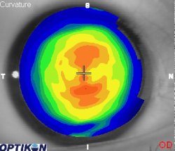 Orthok Demonstration - Patient 006