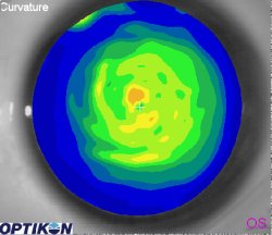 Orthok Demonstration - Patient 007