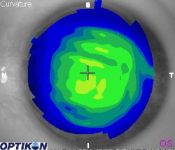 Orthok Demonstration - Patient 009