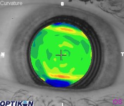 Orthok Demonstration - Patient 010